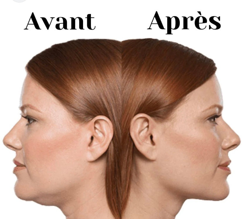 GAINE AMINCISSANT POUR LE VISAGE